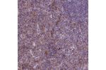Immunohistochemical staining of human spleen shows moderate cytoplasmic positivity in endothelial cells.
