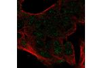 Immunofluorescent staining of human cell line Hep G2 shows localization to nucleoplasm.