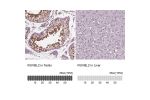 Immunohistochemistry analysis in human testis and liver tissues using Anti-RUVBL2 antibody. Corresponding RUVBL2 RNA-seq data are presented for the same tissues.