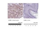 Immunohistochemistry analysis in human heart muscle and skin tissues using HPA067972 antibody. Corresponding ADRB1 RNA-seq data are presented for the same tissues.