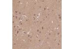 Immunohistochemical staining of human cerebral cortex shows strong cytoplasmic positivity in neuronal cells.