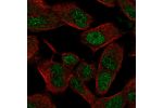 Immunofluorescent staining of human cell line SH-SY5Y shows localization to nucleoplasm.