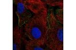 Immunofluorescent staining of human cell line A549 shows localization to plasma membrane.