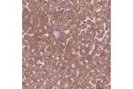 Immunohistochemical staining of human liver shows strong granular cytoplasmic positivity in hepatocytes.