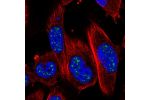 Immunofluorescent staining of human cell line U-251 MG shows localization to nuclear speckles.