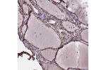 Immunohistochemical staining of human thyroid gland shows moderate to strong nuclear positivity in glandular cells.