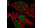 Immunofluorescent staining of human cell line U-2 OS shows localization to nucleoplasm & vesicles.