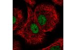 Immunofluorescent staining of human cell line A549 shows localization to nucleoplasm.