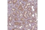 Immunohistochemical staining of human kidney shows strong granular cytoplasmic positivity in cells in tubules.