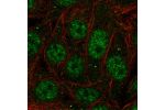 Immunofluorescent staining of human cell line MCF7 shows localization to nuclear speckles & cytoplasmic bodies.