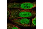 Immunofluorescent staining of human cell line U-2 OS shows localization to nucleoplasm & vesicles.