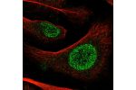 Immunofluorescent staining of human cell line U-2 OS shows localization to nucleoplasm.