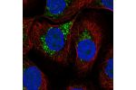 Immunofluorescent staining of human cell line HaCaT shows localization to vesicles.