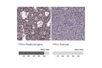 Immunohistochemistry analysis in human parathyroid gland and pancreas tissues using Anti-FTO antibody. Corresponding FTO RNA-seq data are presented for the same tissues.