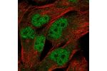 Immunofluorescent staining of human cell line SK-MEL-30 shows localization to nucleoplasm & cytosol.