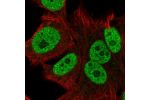 Immunofluorescent staining of human cell line SK-MEL-30 shows localization to nucleoplasm.