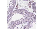 Immunohistochemical staining of human testis shows moderate cytoplasmic positivity in Leydig cells.