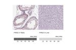 Immunohistochemistry analysis in human testis and prostate tissues using Anti-PIAS2 antibody. Corresponding PIAS2 RNA-seq data are presented for the same tissues.