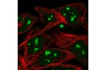 Immunofluorescent staining of human cell line RH-30 shows localization to nucleoli.
