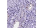 Immunohistochemical staining of human kidney shows moderate luminal membranous positivity in cells in tubules.