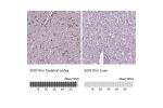 Immunohistochemistry analysis in human cerebral cortex and liver tissues using HPA068898 antibody. Corresponding SOX10 RNA-seq data are presented for the same tissues.