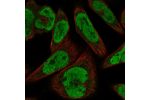 Immunofluorescent staining of human cell line RH-30 shows localization to nucleoplasm & cytosol.