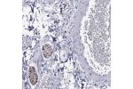 Immunohistochemical staining of human soft tissue shows strong membrane positivity in peripheral nerves.