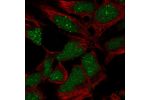 Immunofluorescent staining of human cell line AF22 shows localization to nucleus & nuclear bodies.