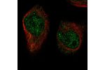 Immunofluorescent staining of human cell line RH-30 shows localization to nucleoplasm & cytosol.