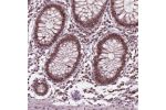 Immunohistochemical staining of human colon shows moderate nuclear positivity in glandular cells.