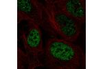 Immunofluorescent staining of human cell line U-2 OS shows localization to nucleoplasm.