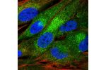 Immunofluorescent staining of human cell line BJ shows localization to cytosol & the Golgi apparatus.