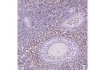 Immunohistochemical staining of human ovary shows moderate cytoplasmic positivity in follicle cell and subset of ovarian stroma cells.