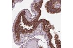 Immunohistochemical staining of human fallopian tube shows strong cytoplasmic positivity with a granular pattern in glandular cells.