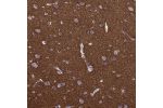 Immunohistochemical staining of human cerebral cortex shows strong cytoplasmic positivity in neuropil.