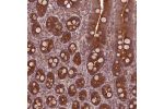 Immunohistochemical staining of human duodenum shows strong cytoplasmic positivity in glandular cells.