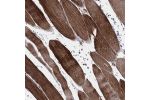 Immunohistochemical staining of human skeletal muscle shows strong cytoplasmic positivity in myocytes.