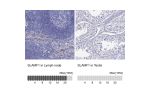 Immunohistochemistry analysis in human lymph node and testis tissues using Anti-SLAMF1 antibody. Corresponding SLAMF1 RNA-seq data are presented for the same tissues.