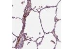 Immunohistochemical staining of human lung shows moderate positivity in secretion.