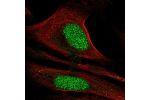 Immunofluorescent staining of human cell line U-2 OS shows localization to nucleoplasm.