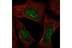 Immunofluorescent staining of human cell line U-2 OS shows localization to nucleus & nucleoli.