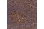 Immunohistochemical staining of human tonsil shows cytoplasmic positivity in germinal center cells.