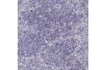 Immunohistochemical staining of human lymph node shows strong cytoplasmic positivity in a subset of non-germinal center cells.