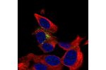 Immunofluorescent staining of human cell line SH-SY5Y shows localization to vesicles.