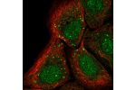 Immunofluorescent staining of human cell line HaCaT shows localization to nucleus & vesicles.