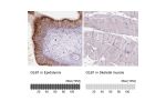 Immunohistochemistry analysis in human epididymis and skeletal muscle tissues using HPA069503 antibody. Corresponding GLB1 RNA-seq data are presented for the same tissues.