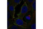 Immunofluorescent staining of human cell line RT4 shows localization to plasma membrane.
