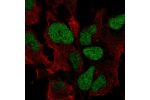 Immunofluorescent staining of human cell line AF22 shows localization to nucleoplasm.