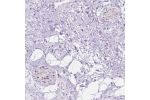 Immunohistochemical staining of human soft tissue shows moderate positivity in peripheral nerves.