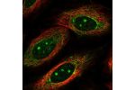 Immunofluorescent staining of human cell line SiHa shows localization to nucleoli & cytosol.